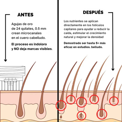 FUSINOVA™ Sistema de Recuperación Capilar