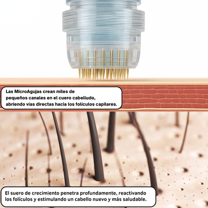 FUSINOVA™ Sistema de Recuperación Capilar