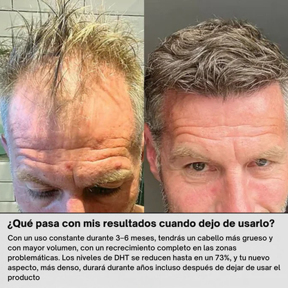 FUSINOVA™ Sistema de Recuperación Capilar