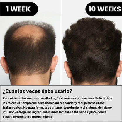 FUSINOVA™ Sistema de Recuperación Capilar