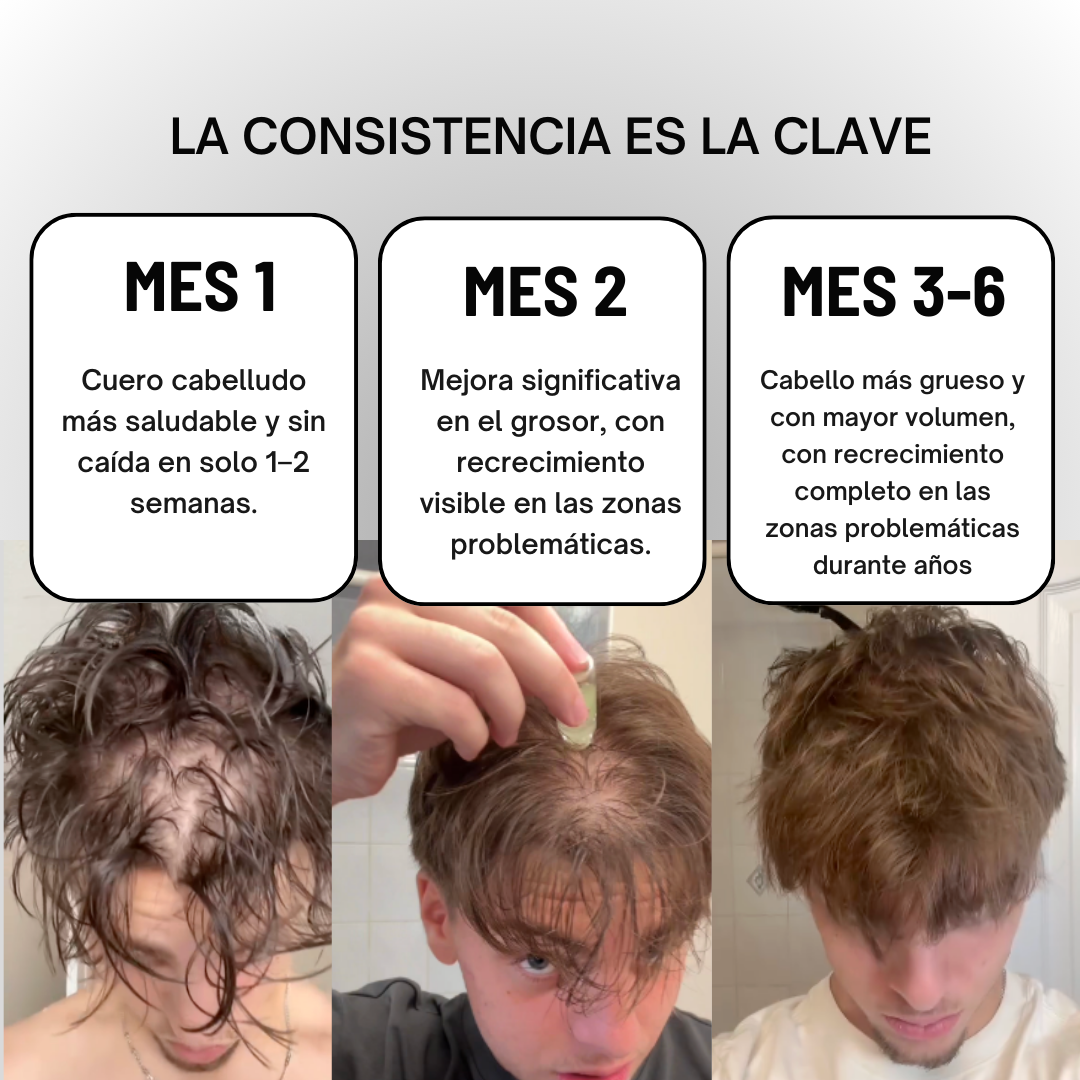 FUSINOVA™ Sistema de Recuperación Capilar