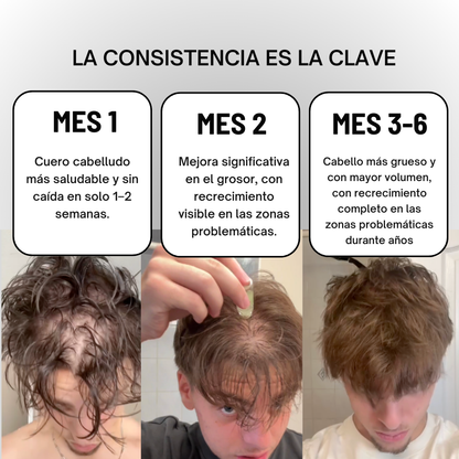 FUSINOVA™ Sistema de Recuperación Capilar